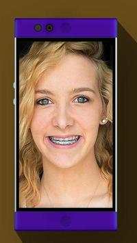 Real Braces Booth HD Studio screenshot 1