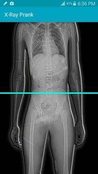 X Ray Scanner Prank screenshot 2
