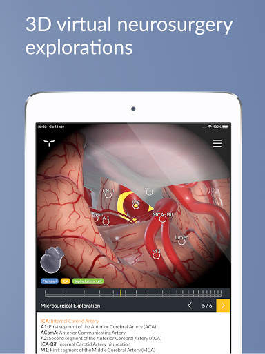 UpSurgeOn Neurosurgery screenshot 11