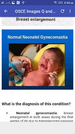 Pediatrics  OSCE Q and A screenshot 7