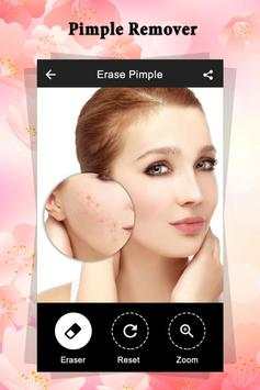 Pimple Remover : Beauty Plus screenshot 6