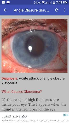 Ophthalmology & Optometry Guide screenshot 6