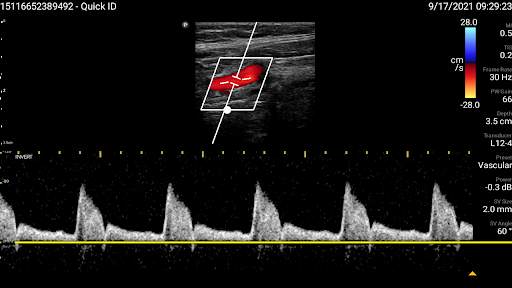 Philips Lumify Ultrasound App screenshot 5