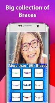 Braces 2018 screenshot 2
