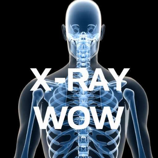 X-RAY WOW 1.3.2