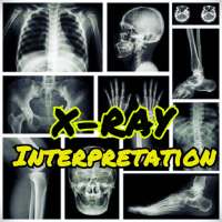 x-ray interpretation guide icon