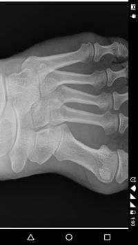 X - Ray Scanner Prank screenshot 8