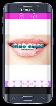 Top Design Braces teeth screenshot 2