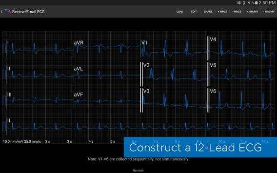 Alirus ECG screenshot 4