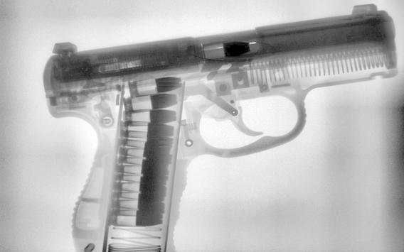 X-ray screenshot 5
