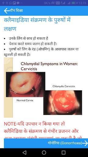 Sex Education in Hindi screenshot 3