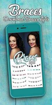 Braces screenshot 4