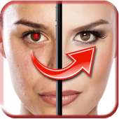 Red Eye Remover icon
