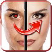 Red Eye Remover 10.0
