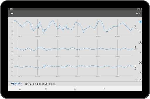 OpenSignals Mobile screenshot 12