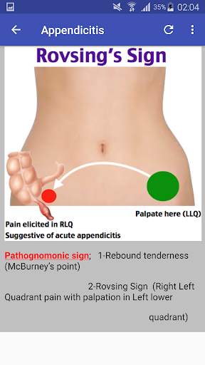 Pathognomonic Sign screenshot 3