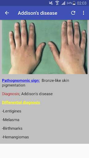 Pathognomonic Sign screenshot 5