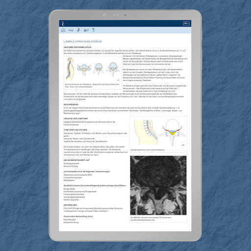 DIE WIRBELSÄULEN APP screenshot 13