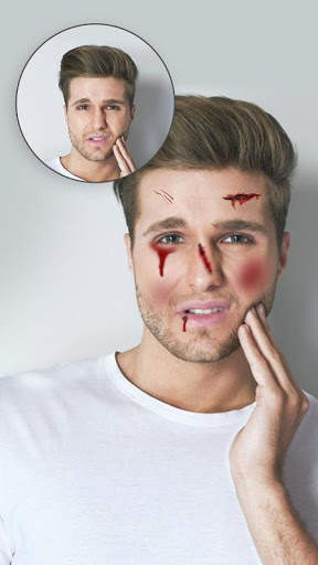 Injury Photo Editor screenshot 1