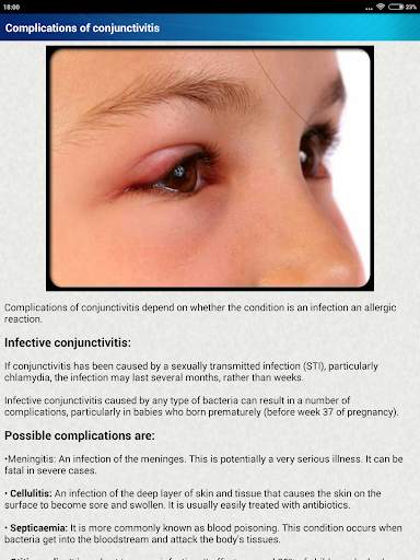 Help for Baby Conjunctivitis & Pinkeye in Children screenshot 13