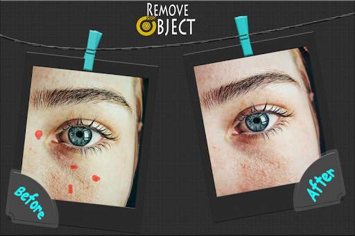 Remove Object from Photo with photo retouch screenshot 4