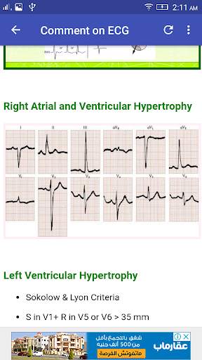 A to Z ECG Interpretation screenshot 6