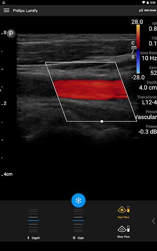 Philips Lumify Ultrasound App screenshot 2