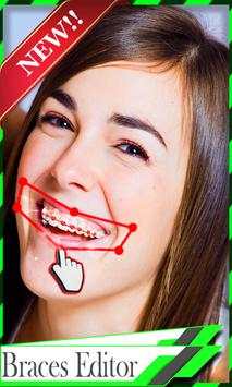 Braces Teeth Camera 3 تصوير الشاشة