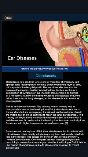 My Ear Anatomy screenshot 5
