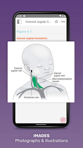 Harriet Lane Handbook App screenshot 3