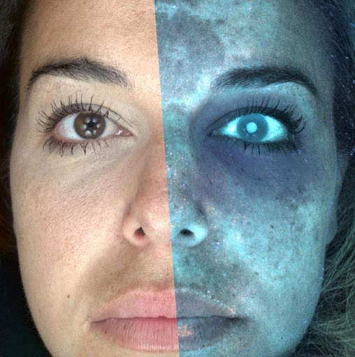 DermIA - Analyze Skin Cancer with your camera A.I screenshot 4