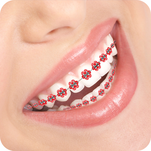 ikon Braces Photo