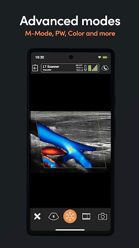Clarius Ultrasound скриншот 4