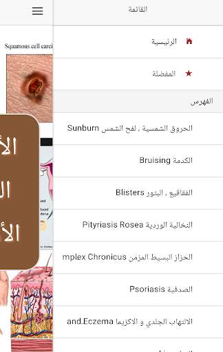 الأمراض الجلدية و التناسلية screenshot 5