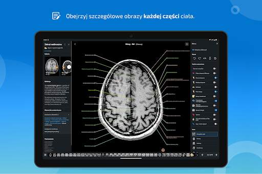e-Anatomy screenshot 13