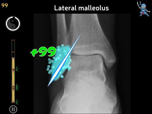 Anatomy Ninja Lower Limb screenshot 14