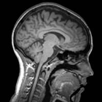 Understanding Medical Scans on 9Apps