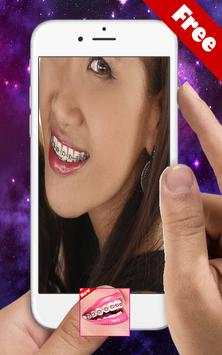 Kawat gigi Gigi Kamera moto screenshot 2