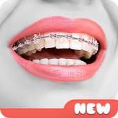 Beauty Brace Camera Snapping 1.0