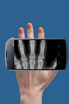 Real X Ray Body Scanner Prank: X Ray App screenshot 2