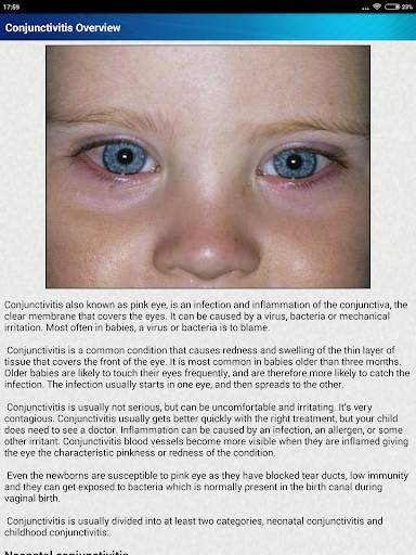Help for Baby Conjunctivitis & Pinkeye in Children screenshot 9