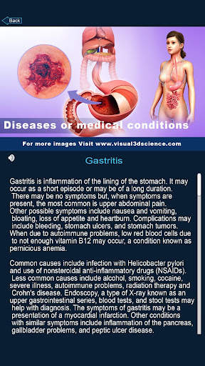 My Stomach Anatomy screenshot 4