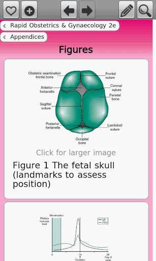 Rapid Obs and Gyn, 2nd Edition screenshot 3