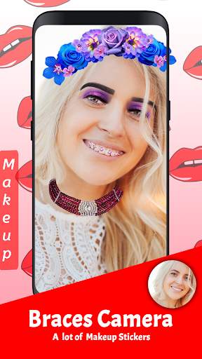 Braces 2019 - Braces Yourself Prank screenshot 5