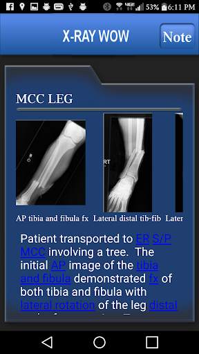 X-RAY WOW screenshot 3