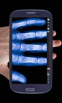 Real X Ray Body Scanner Prank: X Ray App screenshot 1