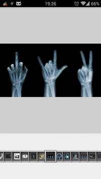 Super Funny X-Ray screenshot 3