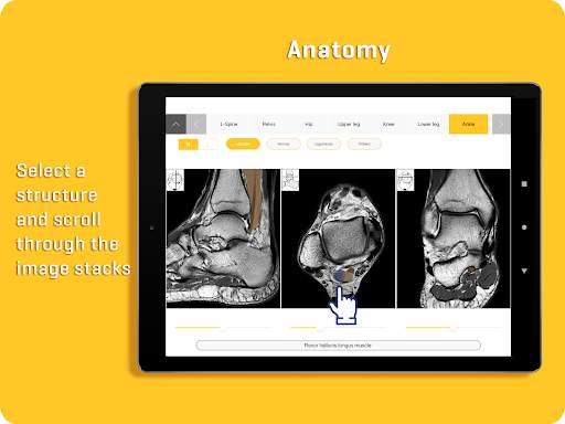 MRI Essentials screenshot 13