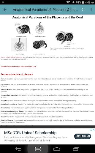 Normal Pregnancy Guide screenshot 5