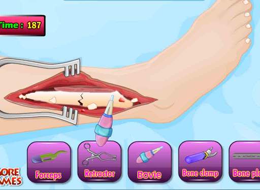 Doktor Tom Beinoperation Spiel screenshot 6